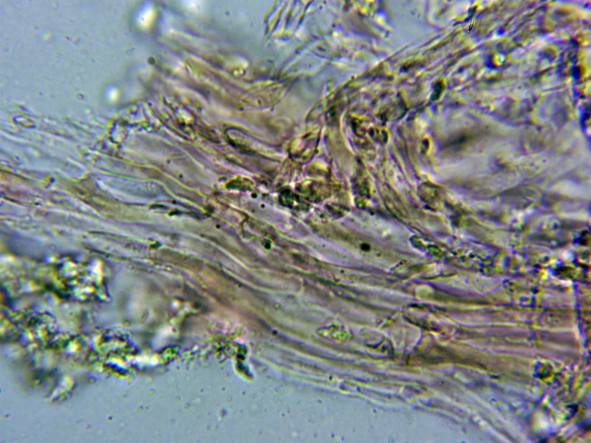 Microscopía de Phlebia radiata - 10 - Hifas subículo